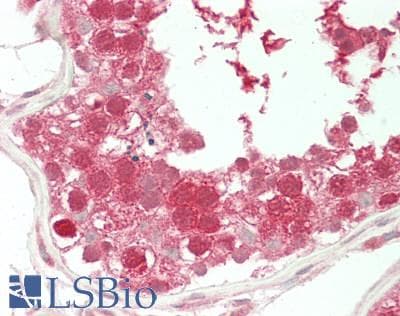 IHC-plus™ Polyclonal Rabbit anti-Human XPO5 / Exportin 5 Antibody (IHC, IF, WB)