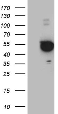 Monoclonal Mouse anti-Human PXN / Paxillin Antibody (clone OTI6G9, Carrier-free, WB)