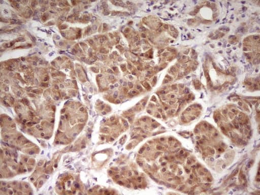 Monoclonal Mouse anti-Human TRB3 / TRIB3 Antibody (clone OTI3F3, Carrier-free, aa1-200, IHC, WB)