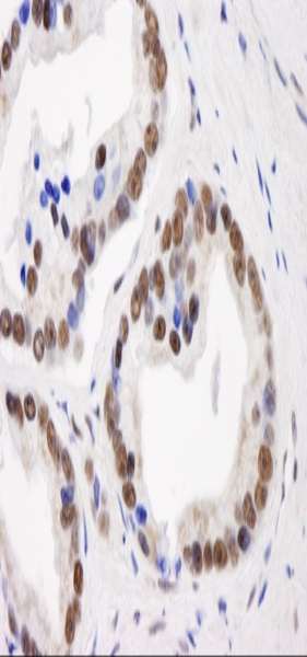 Polyclonal Rabbit anti-Human GTF2I / TFII I Antibody (aa950-C-term, IHC, IF)