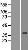 IDI2 Protein (Over-Expression Lysate Myc-DDK (Flag))