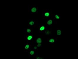 ERCC1 Antibody (clone OTI5E6)