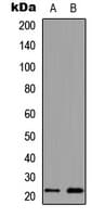 Polyclonal Rabbit anti-Human MYL3 Antibody (Internal, WB)