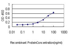 IHC-plus™ CORO1B Antibody (clone 1E7)