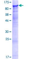 Human SUSD2 Protein (Recombinant GST)