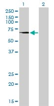 TGM2 / Transglutaminase 2 Antibody (clone 2F4)