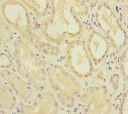 MMACHC Antibody