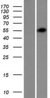 TRIM62 Protein (Over-Expression Lysate Myc-DDK (Flag))
