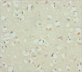 Polyclonal Rabbit anti-Human CACNB1 Antibody (IHC, WB)