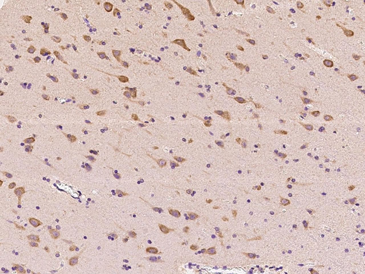 RARS Antibody