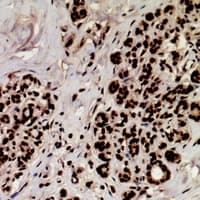 MEF2A / MEF2 Antibody