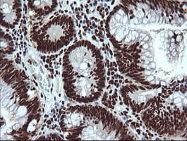 Monoclonal Mouse anti-Human SAE1 Antibody (clone 1G8, Carrier-free, IHC, IF, WB)