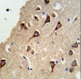 Polyclonal Rabbit anti-Human SYN / FYN Antibody (aa1-30, IHC, WB)