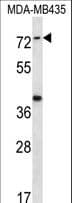 Polyclonal Rabbit anti-Human SYTL1 Antibody (aa296-325, WB)