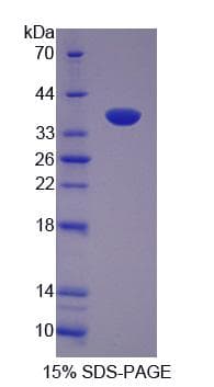 Human FLII / FLI Protein (Recombinant His-S)