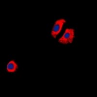 CYSLTR1 / CYSLT1 Antibody (Internal)