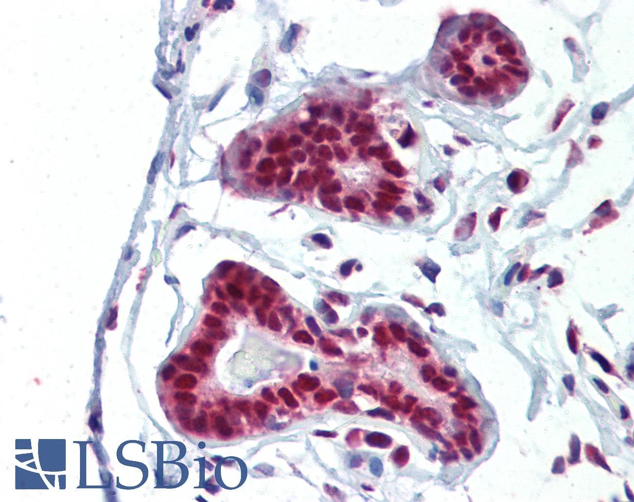 IHC-plus™ Polyclonal Rabbit anti-Human PRMT1 Antibody (aa316-347, IHC, WB)