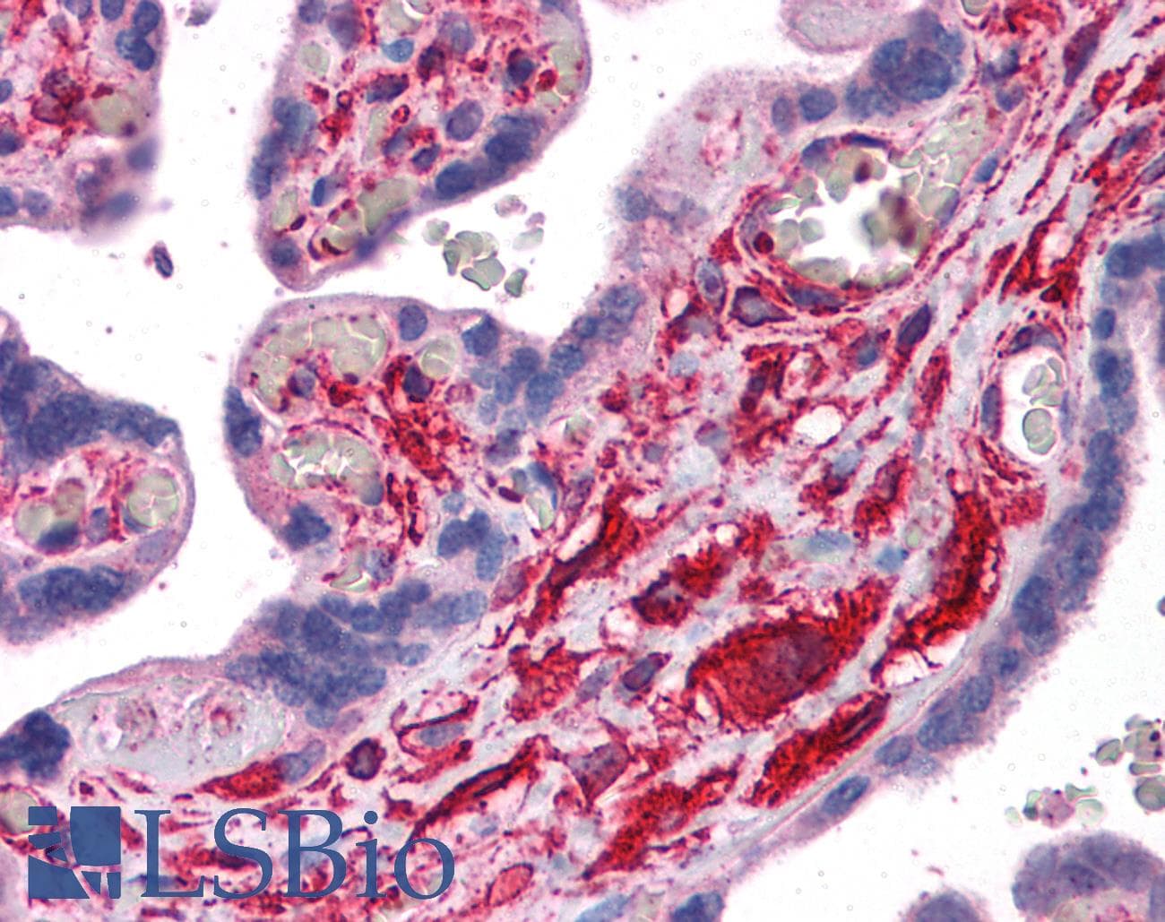 IHC-plus™ Polyclonal Rabbit anti-Human FLNA / Filamin A Antibody (IHC, IF, WB)