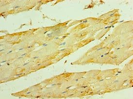 Polyclonal Rabbit anti-Human HSPB2 / HSP27 Antibody (aa1-182, IHC)
