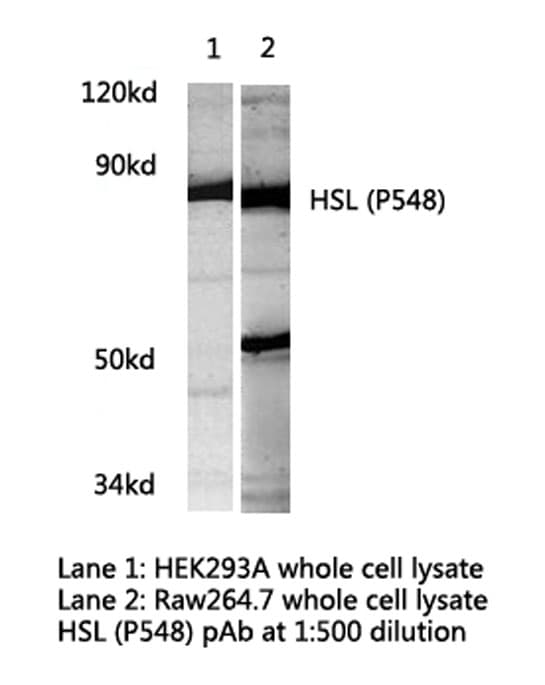 LIPE / HSL Antibody (Pro548)