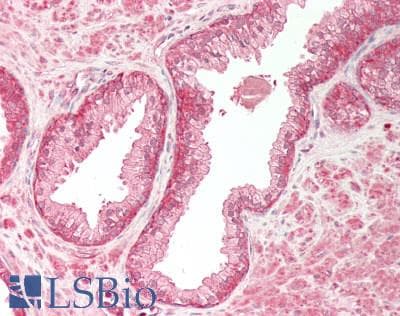 PathPlus™ Polyclonal Rabbit anti-Human CSPG4 / NG2 Antibody (IHC, WB)