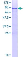 Human ASPIC1 / CRTAC1 Protein (Recombinant GST)