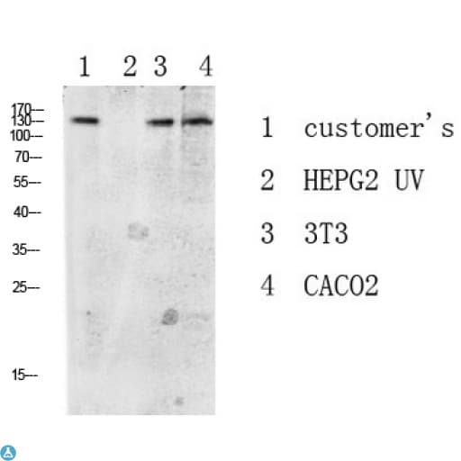 NEP / DDR1 Antibody