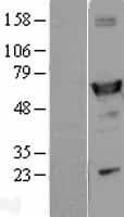 ALDH1A1 / ALDH1 Protein (Over-Expression Lysate Myc-DDK (Flag))