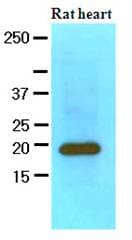 IHC-plus™ Monoclonal Mouse anti-Human MYL2 Antibody (clone AT3B2, IHC, WB)