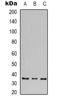 Polyclonal Rabbit anti-Human CACNG5 Antibody (IHC, WB)