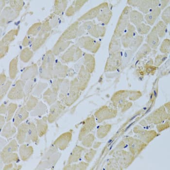 Polyclonal Rabbit anti-Human CA3 / Carbonic Anhydrase III Antibody (IHC, IF, WB)