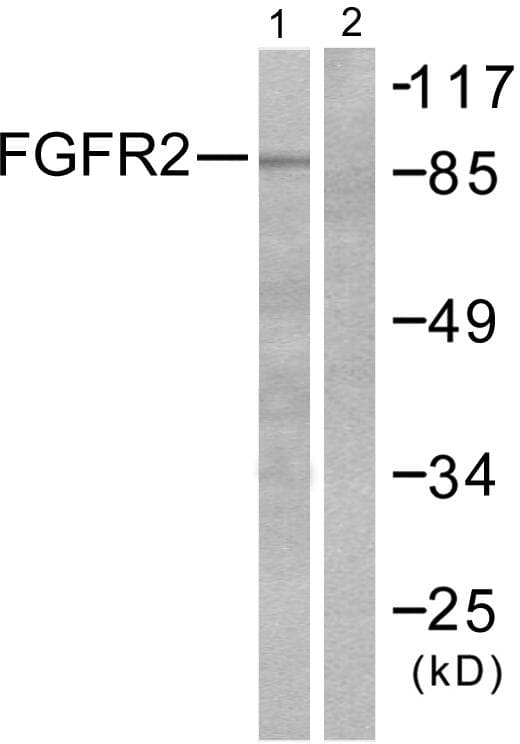 Polyclonal Rabbit anti-Human FGFR2 / FGF Receptor 2 Antibody (IHC, WB)