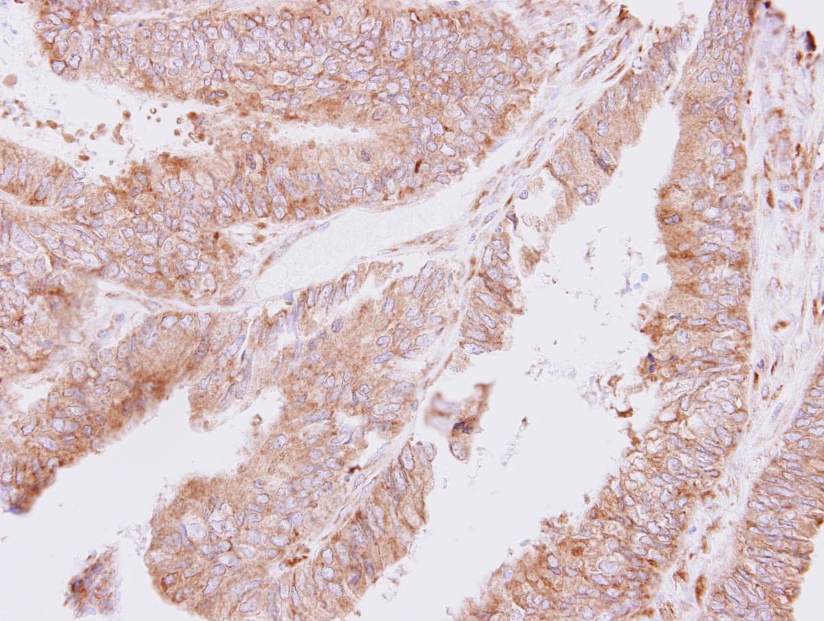 Polyclonal Rabbit anti-Human TARS Antibody (IHC, WB)