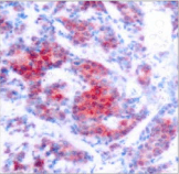 Polyclonal Rabbit anti-Human STAT4 Antibody (IHC, WB)