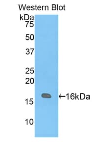 VIP Antibody (aa34-157)