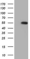 Monoclonal Mouse anti-Human SPATA2L Antibody (clone OTI3H8, aa179-424, WB)