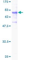 Human ECSIT Protein (Recombinant GST)