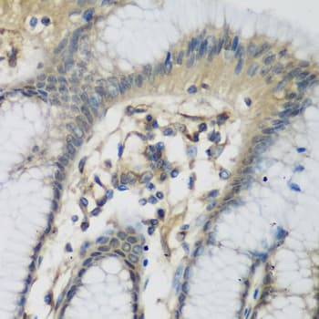 Complement C1s Antibody