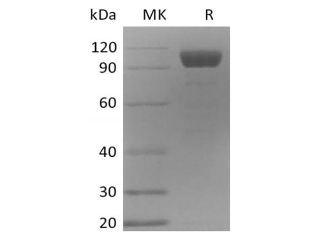 Mouse ANGPT2 / Angiopoietin-2 Protein (Recombinant Fc, C-terminus)