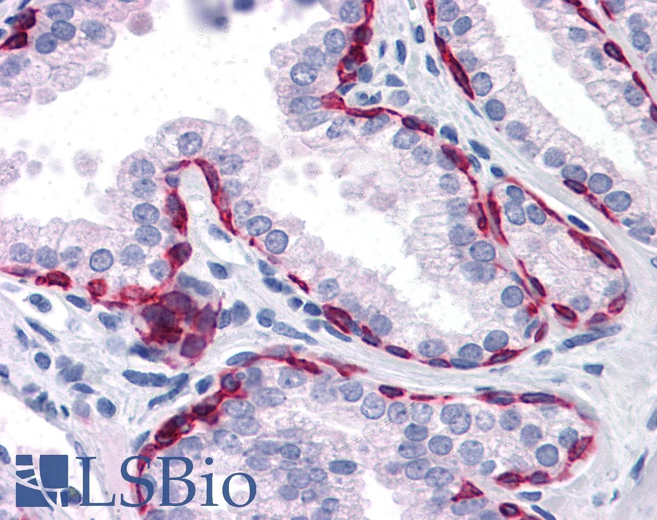 IHC-plus™ KRT81 / Keratin 81 / KRTHB1 Antibody (clone 3B10-5B10)