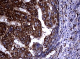 PIK3C2A Antibody (aa230-560, clone OTI4E6)
