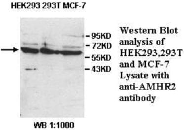 IHC-plus™ Polyclonal Rabbit anti-Human AMHR2 / MISRII Antibody (aa207-440, IHC, WB)