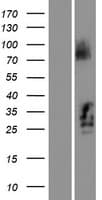 C21orf62 Protein (Over-Expression Lysate Myc-DDK (Flag))