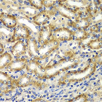 Polyclonal Rabbit anti-Human DGKE / DGK Epsilon Antibody (IHC, WB)