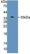 Human ARSF / Arylsulfatase F Protein (Recombinant His, N-Terminal)