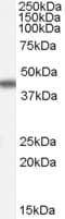 IHC-plus™ Polyclonal Goat anti-Human APOA4 Antibody (aa359-371, IHC, WB)