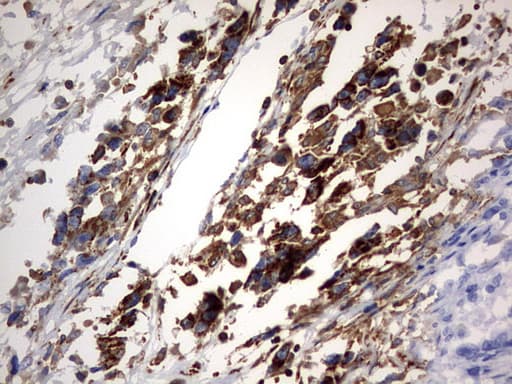 PLOD2 Antibody (aa359-640, clone OTI7G5)