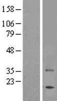 TAS2R7 / T2R7 Protein (Over-Expression Lysate Myc-DDK (Flag))