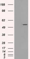 Monoclonal Mouse anti-Human SLC2A5 / GLUT5 Antibody (clone OTI11E1, IF, WB)