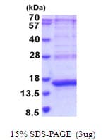 Human CD66d / CEACAM3 Protein (Recombinant His)